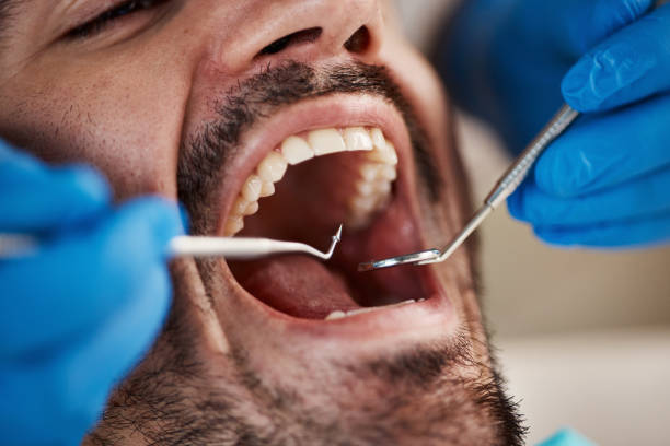 Best Emergency Wisdom Teeth Removal in Sheldon, IL