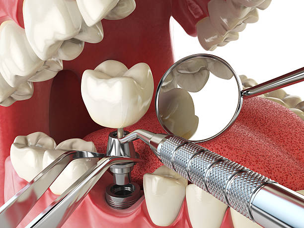 Best Walk-In Emergency Dentist in Sheldon, IL